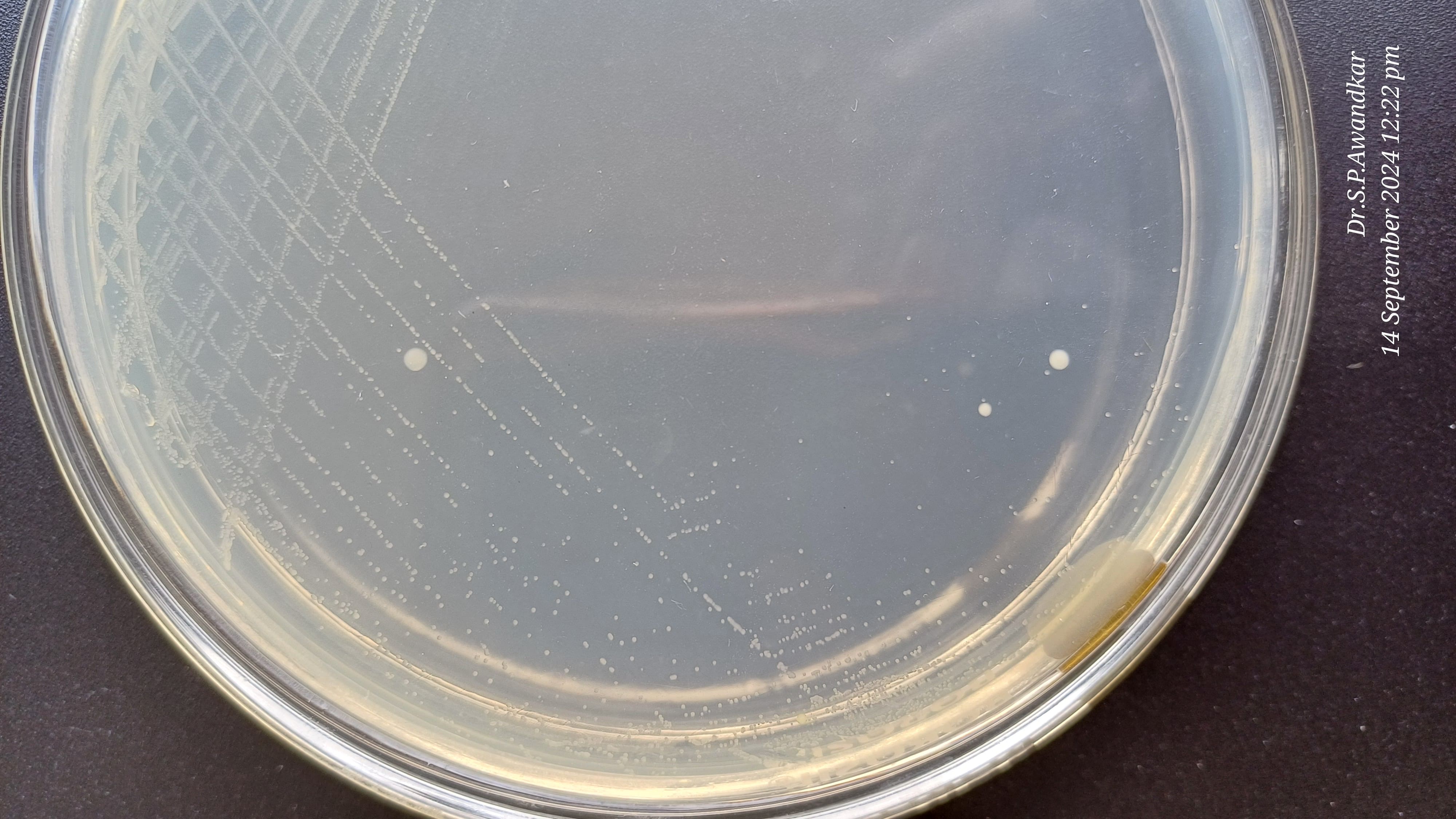 16. Streptococcus Spp.